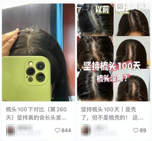 经常梳头 vs 不怎么梳头，到底哪种更健康？